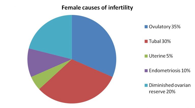 Female causes of infertility: ovulatory 35%, tubal 30%, uterine 20%, endometriosis 10%, diminished ovarian reserve 5%